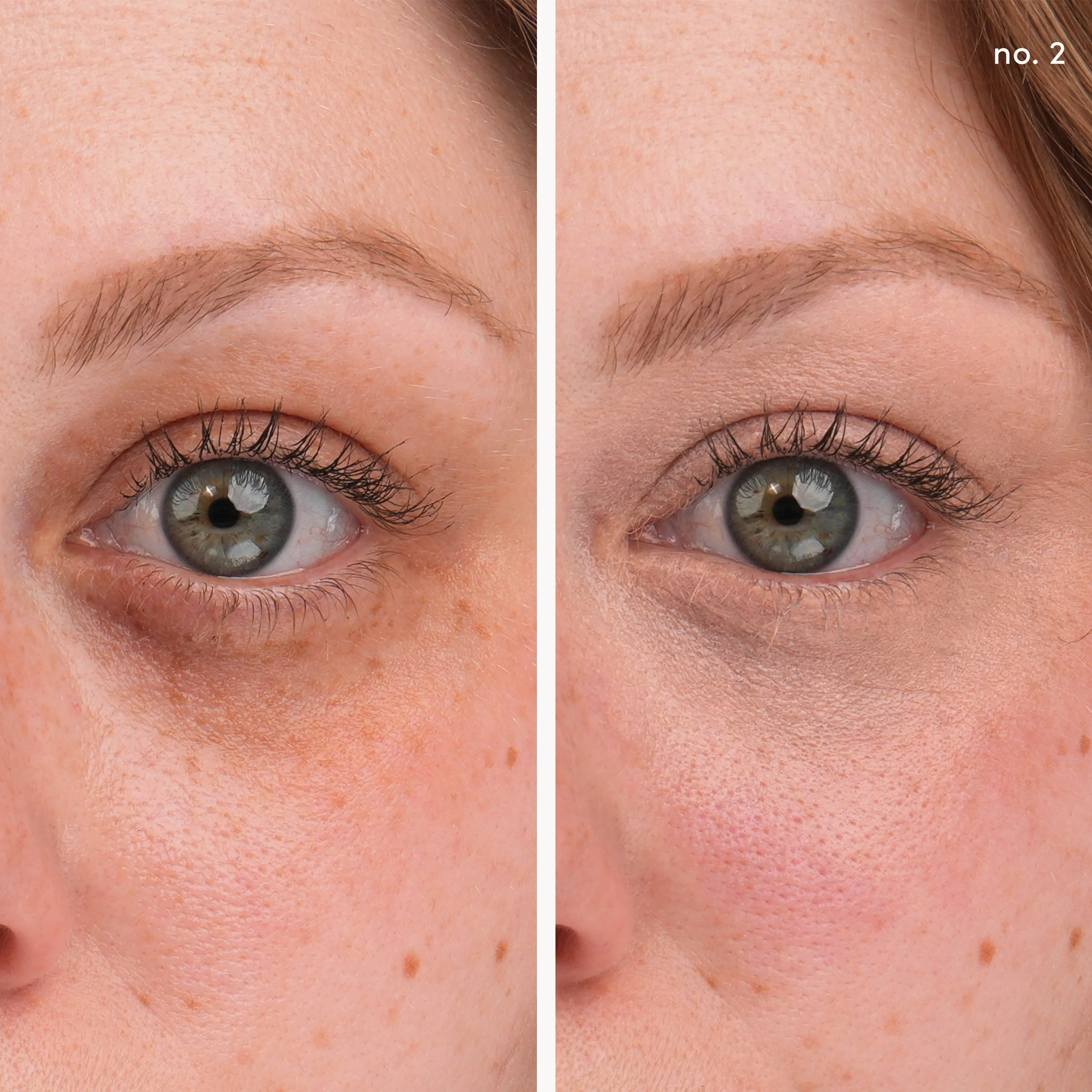 Circle\Delete® Concealer - Image 12